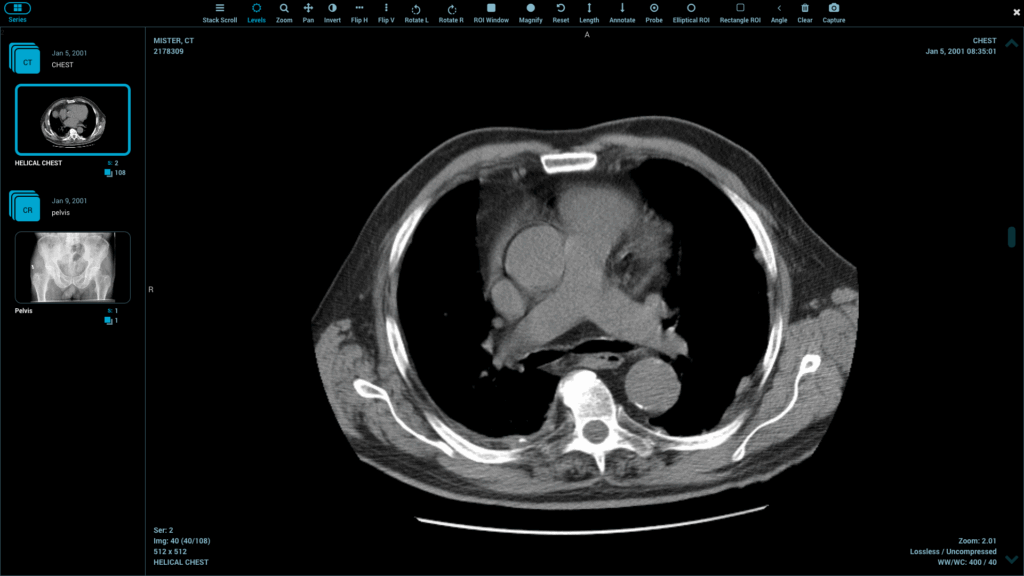 online DICOM reader